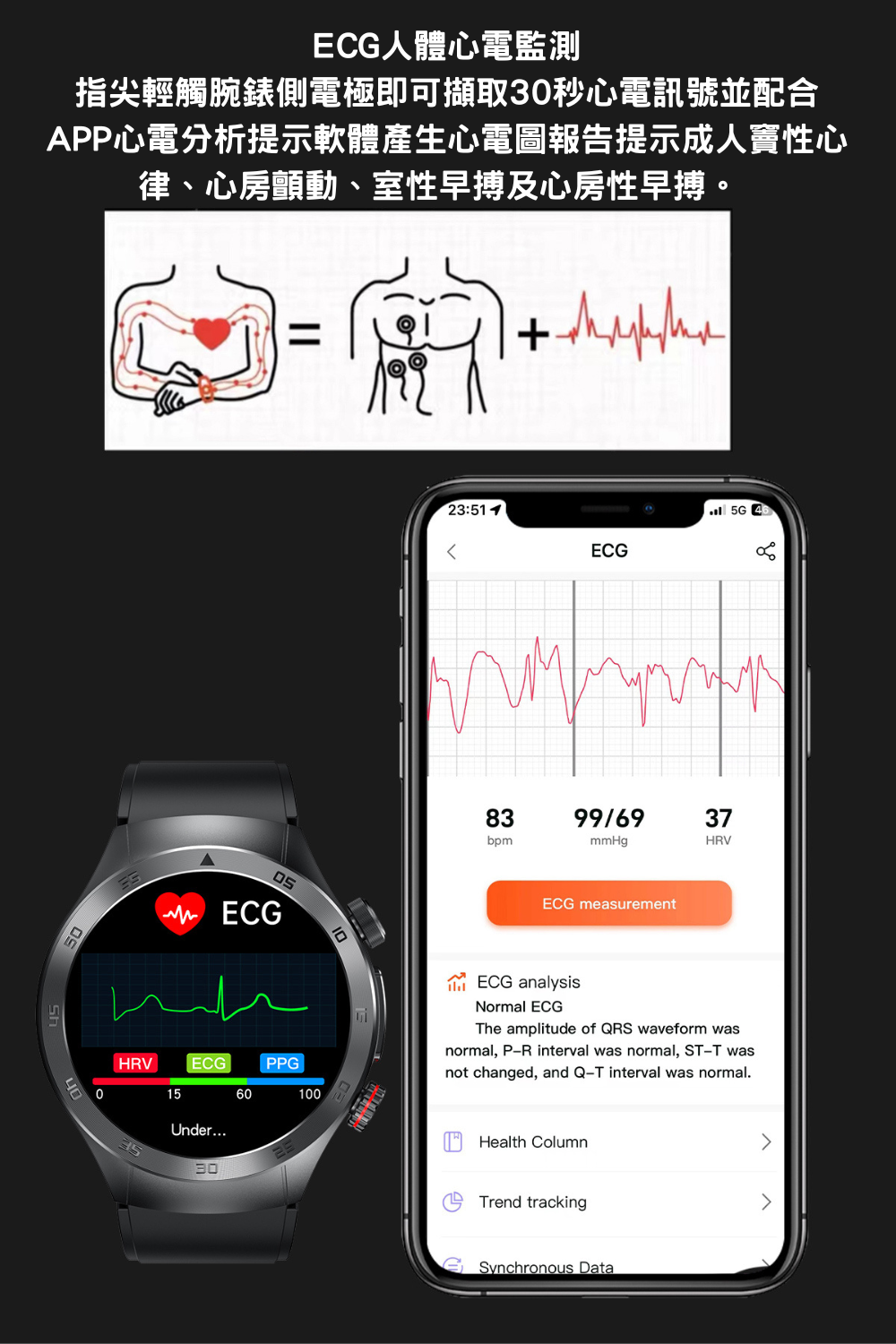多功能激光理療智能手錶 E800無創血糖尿酸監測手錶
