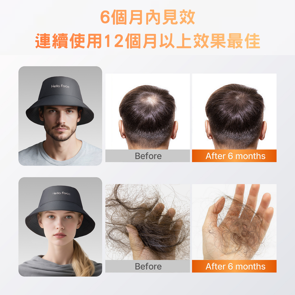 無線深層紅光生髮帽 豐盈告別脫髮
