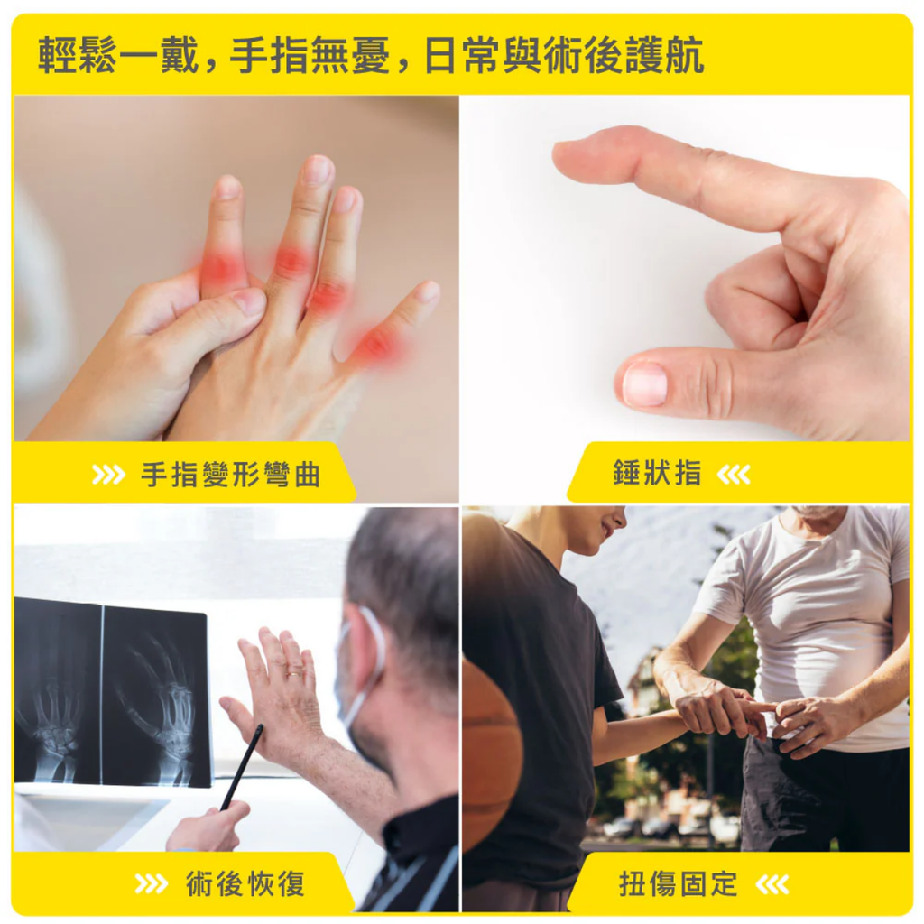 BRACOO熱塑強固型透氣手指護具 - 強力支撐與防護 – Meds Care